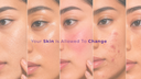 Your Skin Is Allowed To Change
