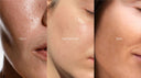 Oily, Dry, or Sensitive Skin? How to Pick the Perfect Moisturizer!