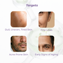 Before and after using serum and moisturizer combo showing smoother, hydrated, and balanced skin